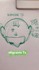 zhu scalp acupuncture