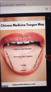 the tongue in chinese medicine